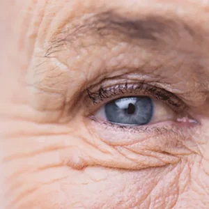 Lutein and Zeaxanthin: Their Effects on Eye Health and Best Sources